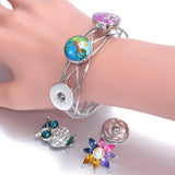 12pcs Girls Cats Glass Snap Button for Bracelet Snaps Jewel
