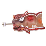 Anatomy Model Human Rectal Hemorrhoid Lesion Model Pathology Teaching Model