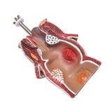 Anatomy Model Human Rectal Hemorrhoid Lesion Model Pathology Teaching Model