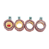 Atherosclerosis Thrombosis Model Heart Vascular Pathology Demo