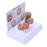 Atherosclerosis Thrombosis Model Heart Vascular Pathology Demo