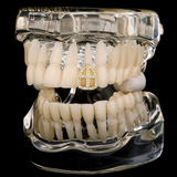 Crystal Tooth Cap Grillz Hip Hop Teeth Brace Women Men Single Cross Piercing