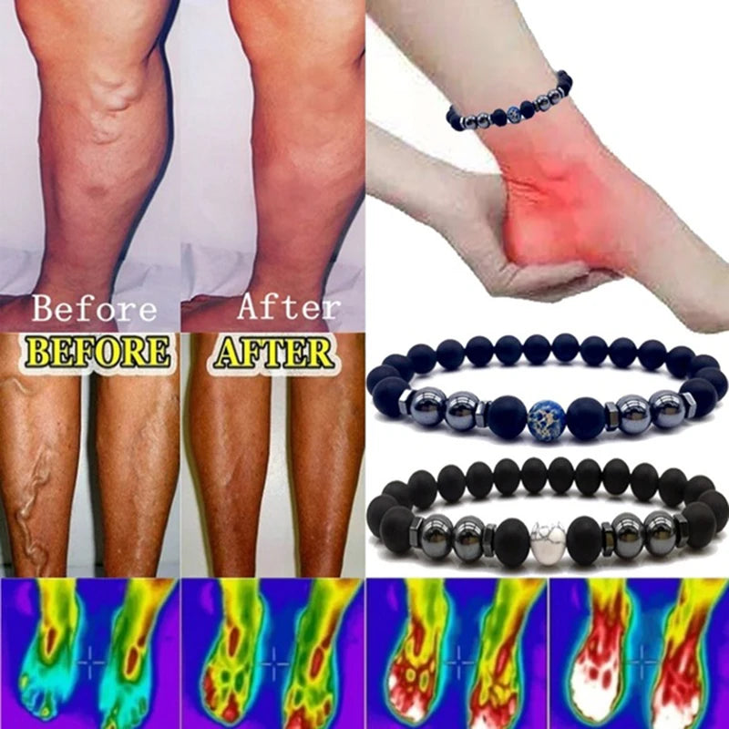 Magnet Anklet Colorful Stone Weight Loss Magnetic Therapy Bracelet
