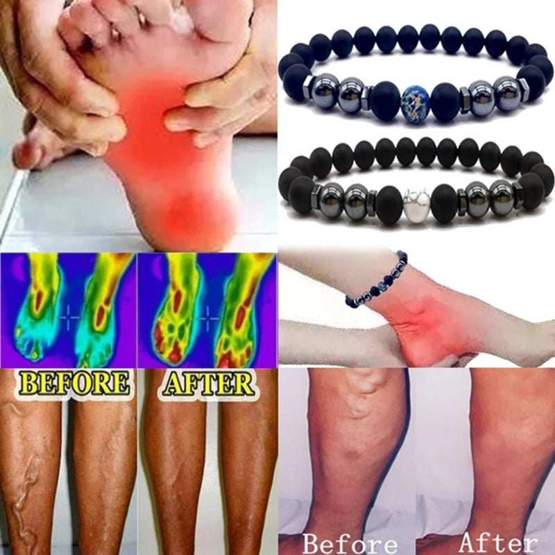 Magnet Anklet Colorful Stone Weight Loss Magnetic Therapy Bracelet