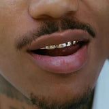 RACHELZ Classic 6/6 Teeth Grillz 14K Plated Dental Grills