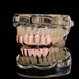 RACHELZ Hip Hop 6/6 Sm Symbol Grillz 14K Plated Dental Grills