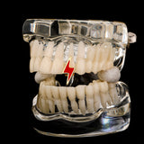 RACHELZ Punk Red Lightning Single Teeth Grillz 14K Plated Tooth Caps