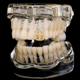 Crystal Tooth Cap Grillz Hip Hop Teeth Brace Women Men Single Cross Piercing