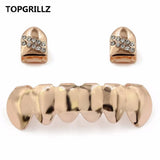 Yellow Plated CZ Stone Top Grillz & Classic Bottom