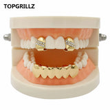 Yellow Plated CZ Stone Top Grillz & Classic Bottom
