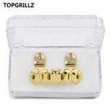 Yellow Plated CZ Stone Top Grillz & Classic Bottom