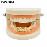 Yellow Plated Drip Bottom Tooth Grillz
