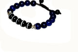 Tibetan DZI Bracelet 10mm Red/White Agate Beads