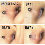 Silicone Piercing Healing Discs Anti Hyperplasia For Earrings