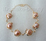 17mm Baroque Freshwater Pearl Bracelet